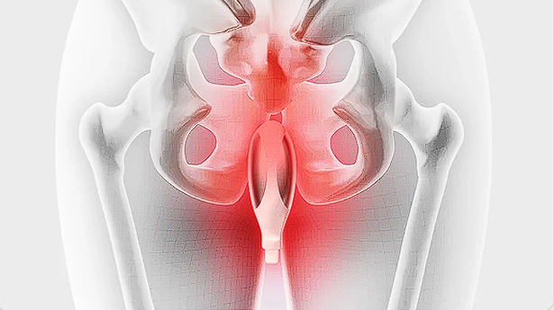 Pelvic floor illustration